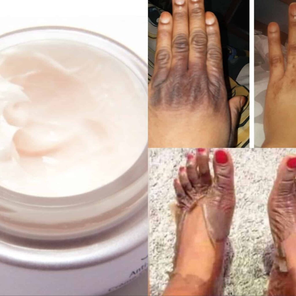 Nigerian Women Desire Fair Skin, But At What Cost