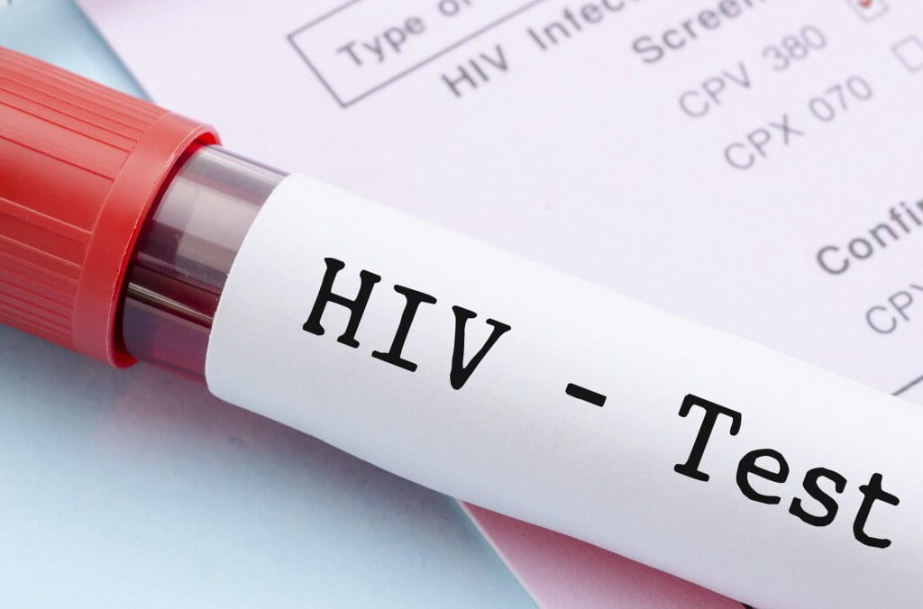 40 mass wedding candidates tested positive to HIV, pregnancy, others - Hisbah