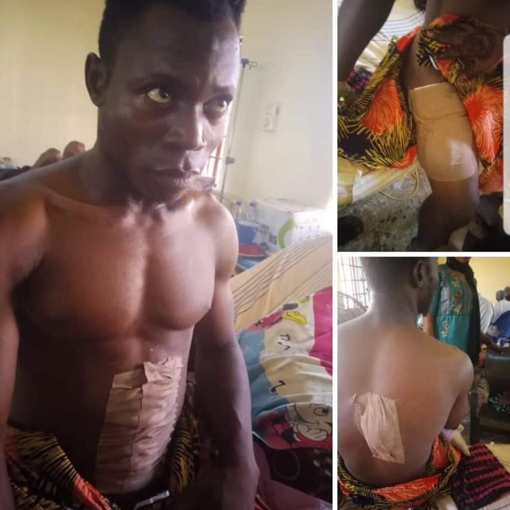 Family of Gandu attack victim in Nasarawa begs Gov. Sule, others for assistance