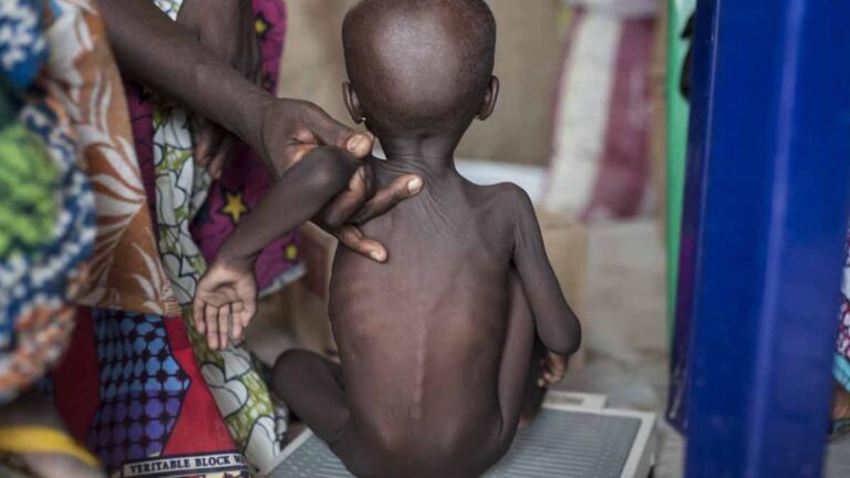 Acute malnutrition reason for stunting of 23% Cross River toddlers - UNICEF